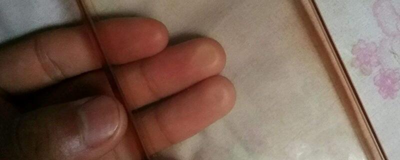 清洁手机壳的方法